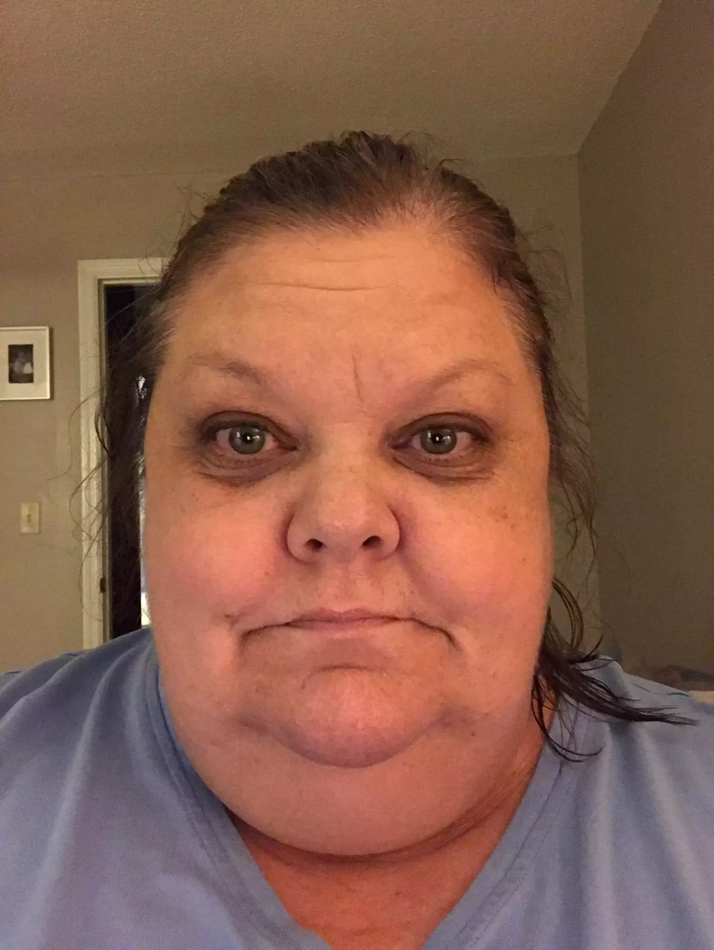 Joanna weighed 35 stone at her heaviest (SWNS)