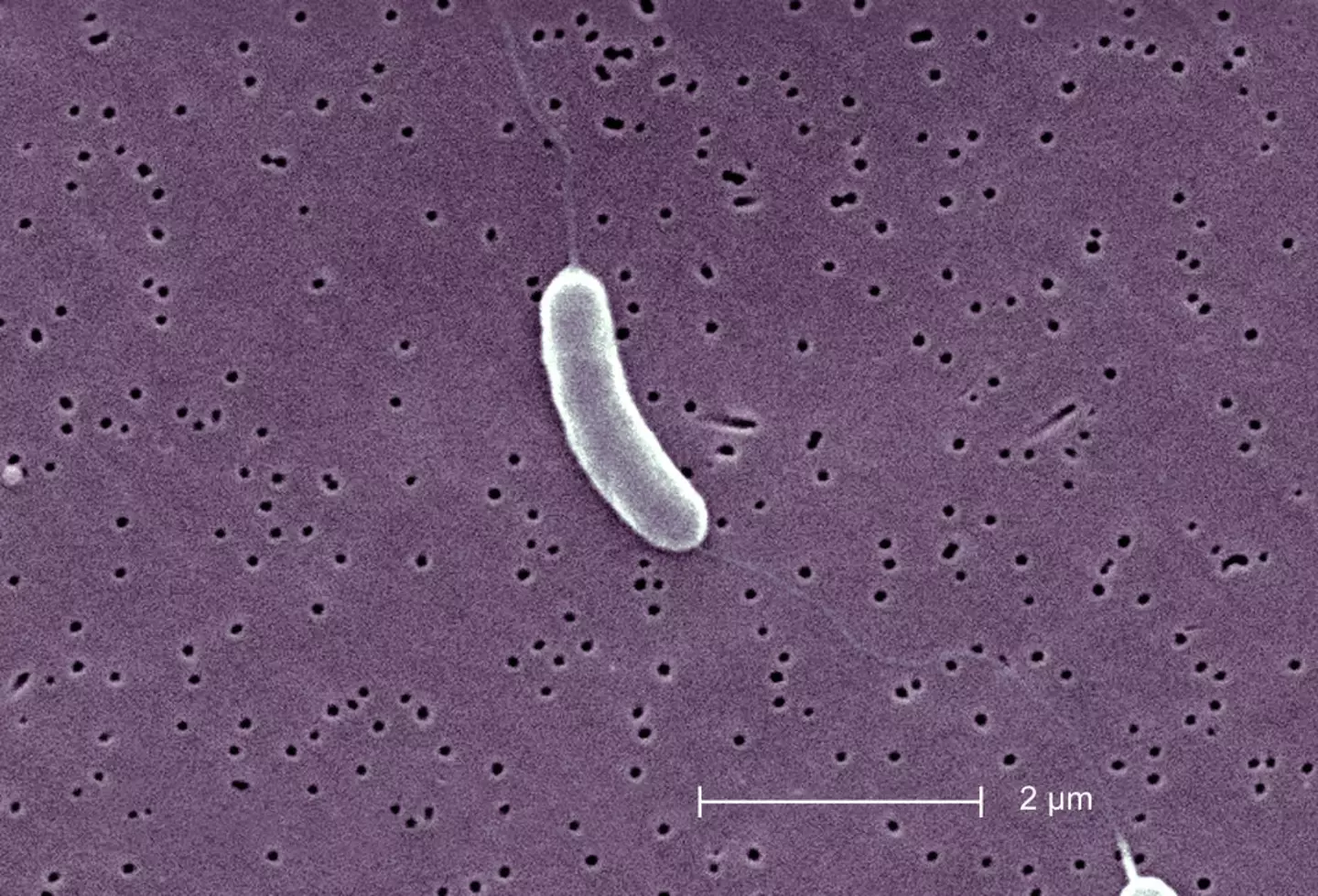 Vibrio vulnificus can be contracted through seawater entering open wounds (BSIP/UIG Via Getty Images)