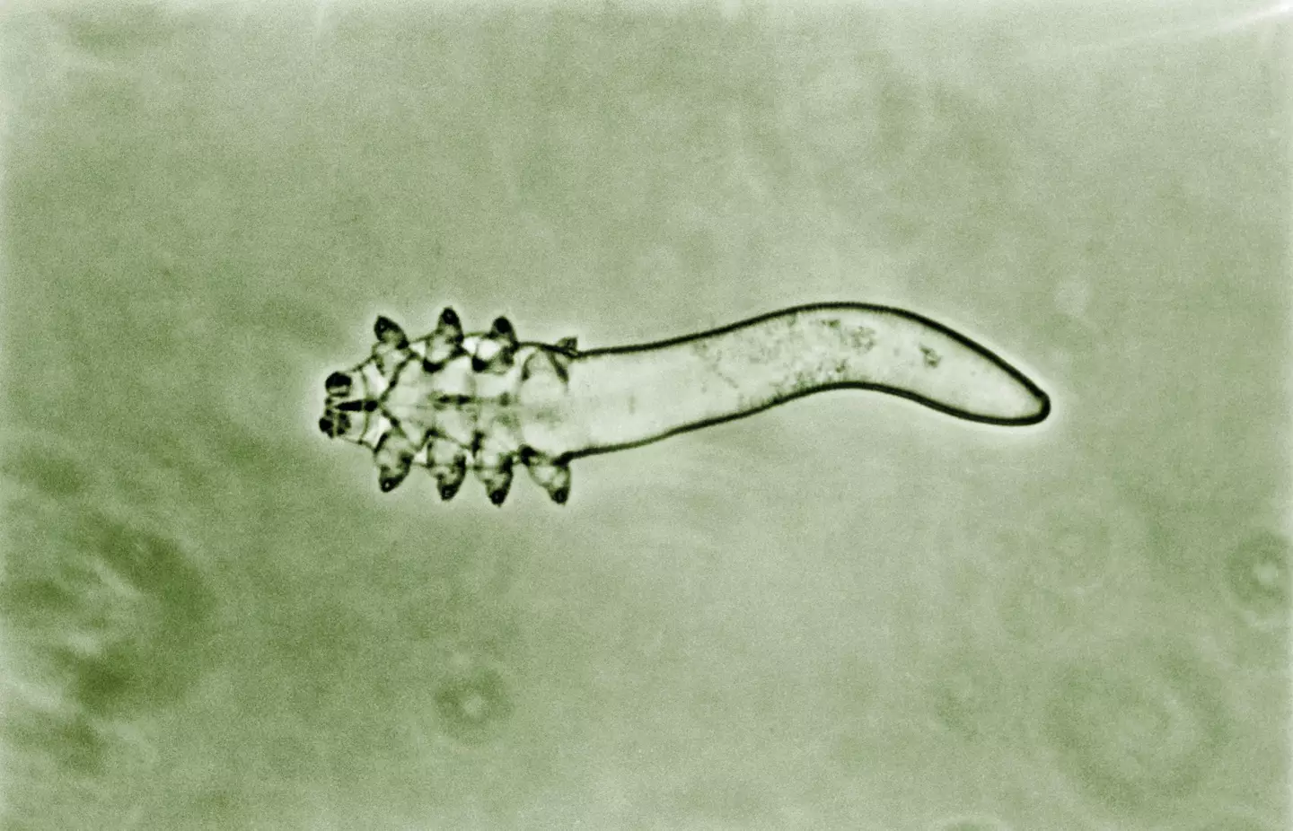 Demodex folliculorum mites live in human pores.