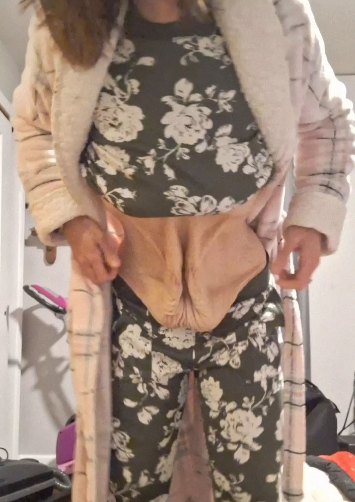 Danielle is raising money so she can afford to remove the excess skin after her weight loss.(Kennedy News and Media)