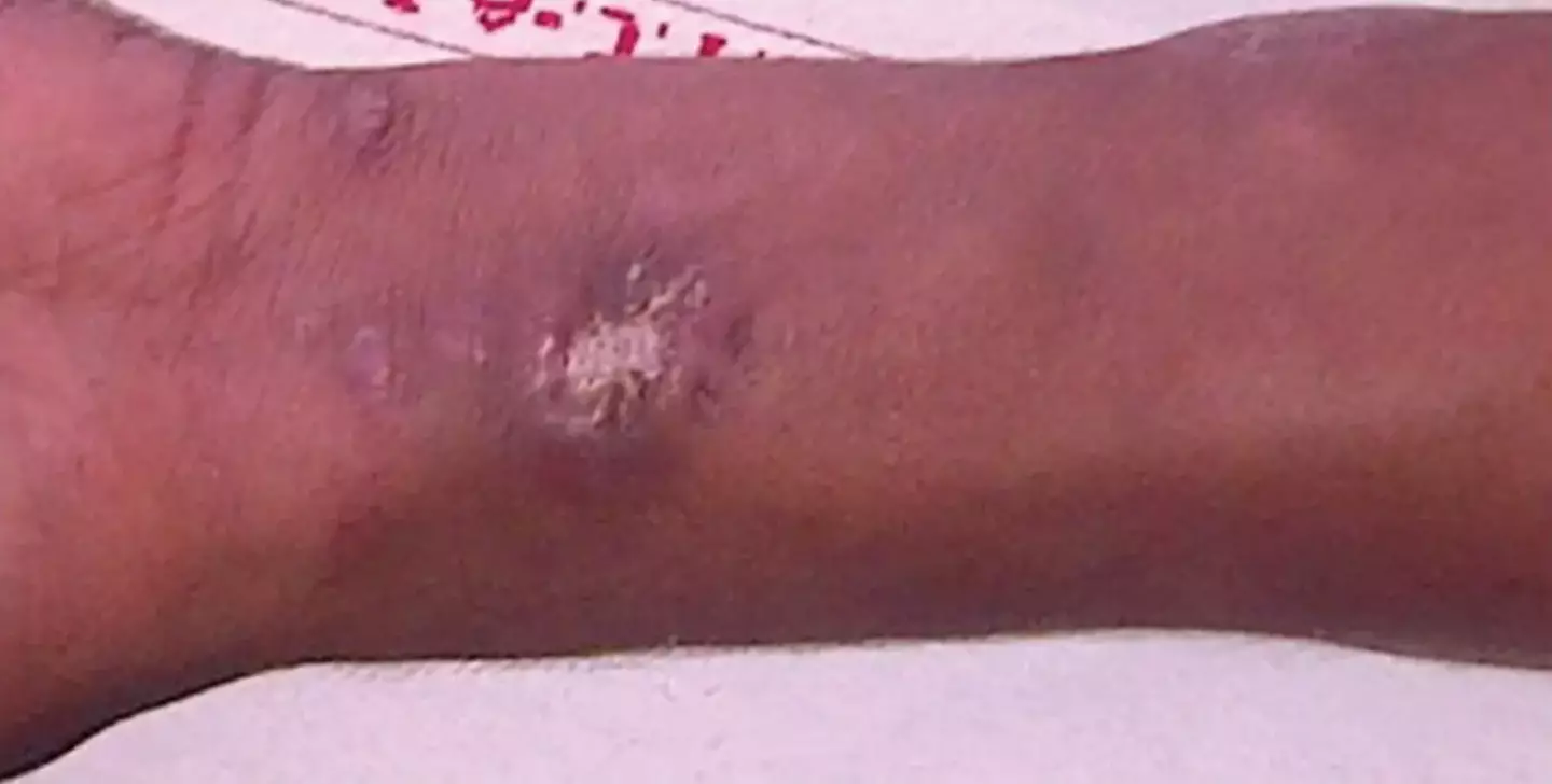 The lad was left hospitalised.