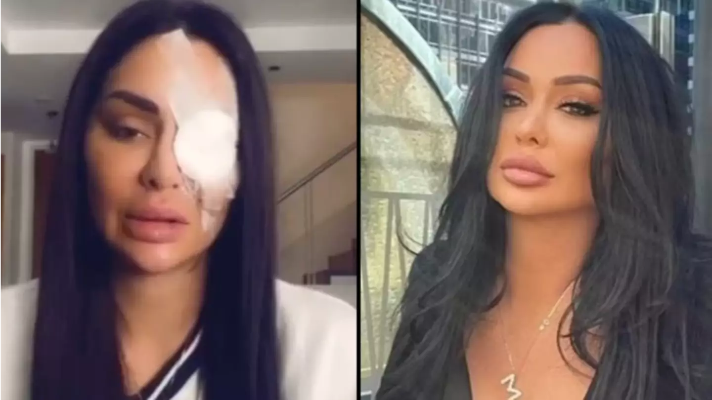 Aussie TikTok Star Was Asked Ominous Question Before Having Acid Thrown In Her Face