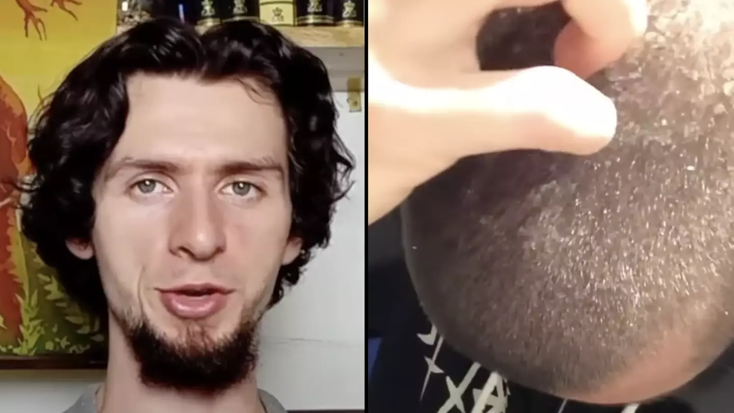 Man who hasn't used shampoo for eight years shows off remarkable results