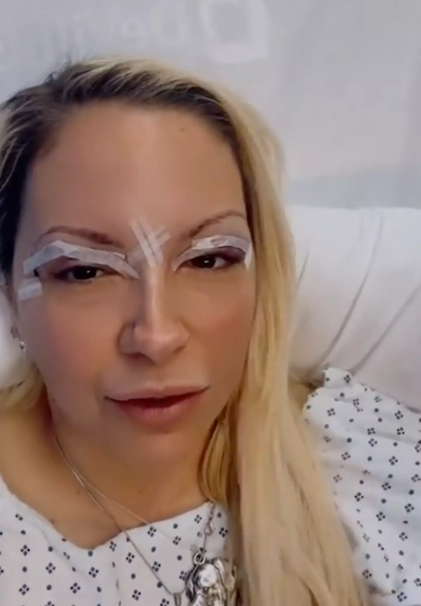 The former model underwent plastic surgery treatment on her eyes earlier this month (Instagram/@jodiemarshtv)