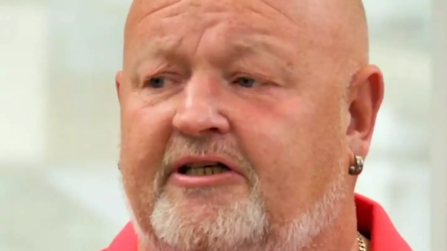Man discovers what lump on head is 30 years after being hit by cricket ball