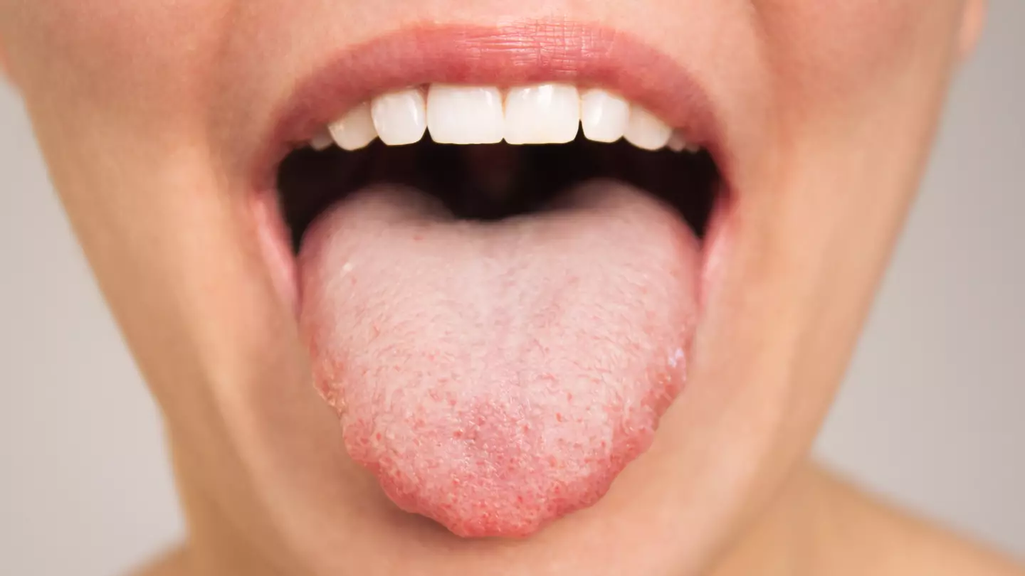 All causes of 'vaper's tongue' side effect that can lead to shocking long-term impact