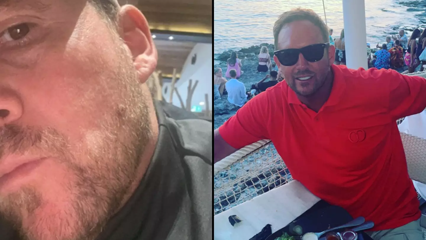 Man who hid ingrown hair with beard for years left stunned after learning devastating truth