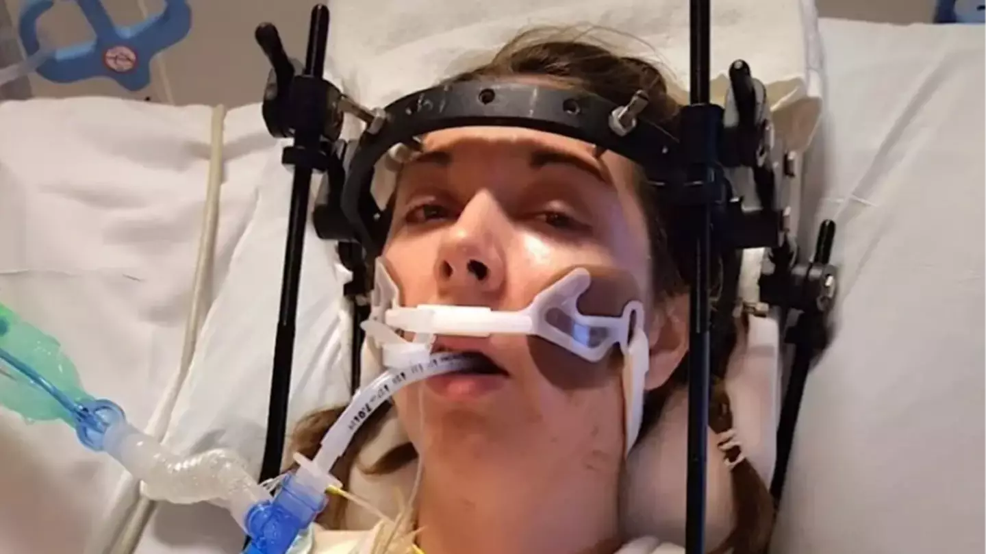 Woman whose head was 'decapitated' following 'horror' accident has it successfully reattached