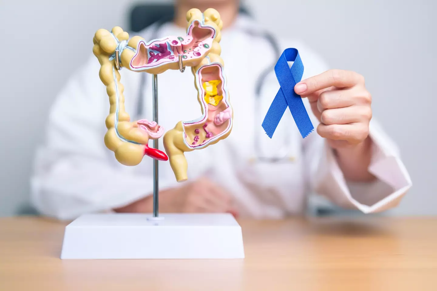 Around half of colorectal cancer cases in under 40s can be linked to the toxin colibactin, according to new research (Panuwat Dangsungnoen/Getty)