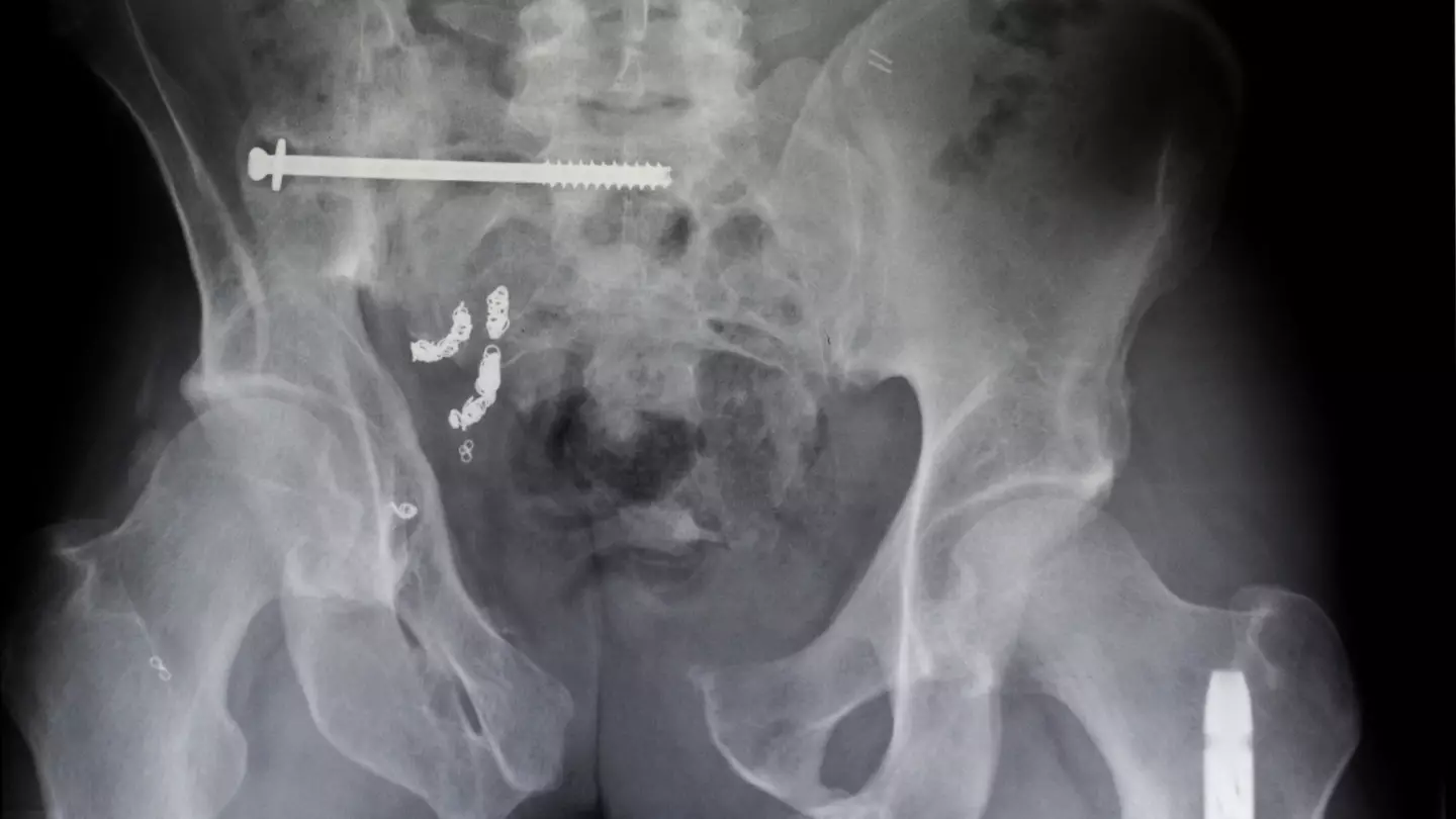 Ron Antonelli/NY Daily News Archive via Getty Images