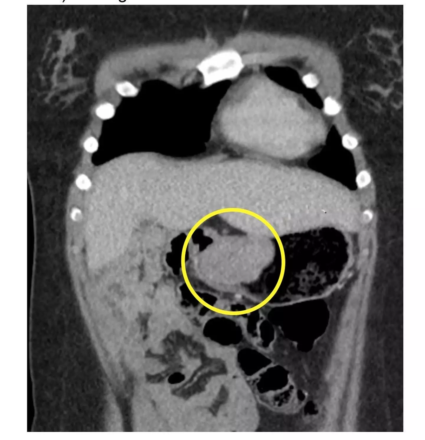 Bella had a large tumour in her stomach. (Kennedy News and Media)