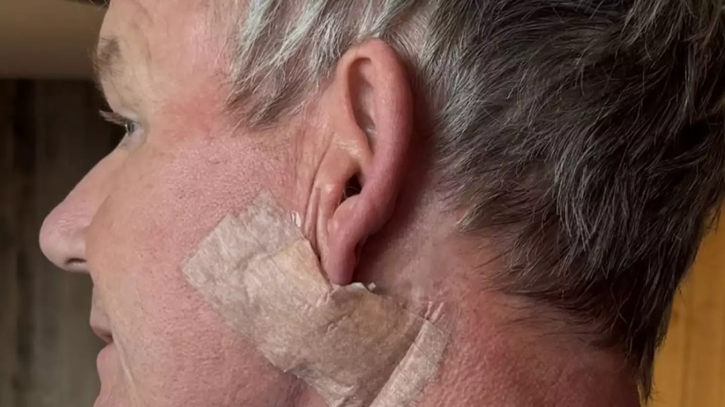 Symptoms of skin cancer as Gordon Ramsey issues serious warning after undergoing surgery