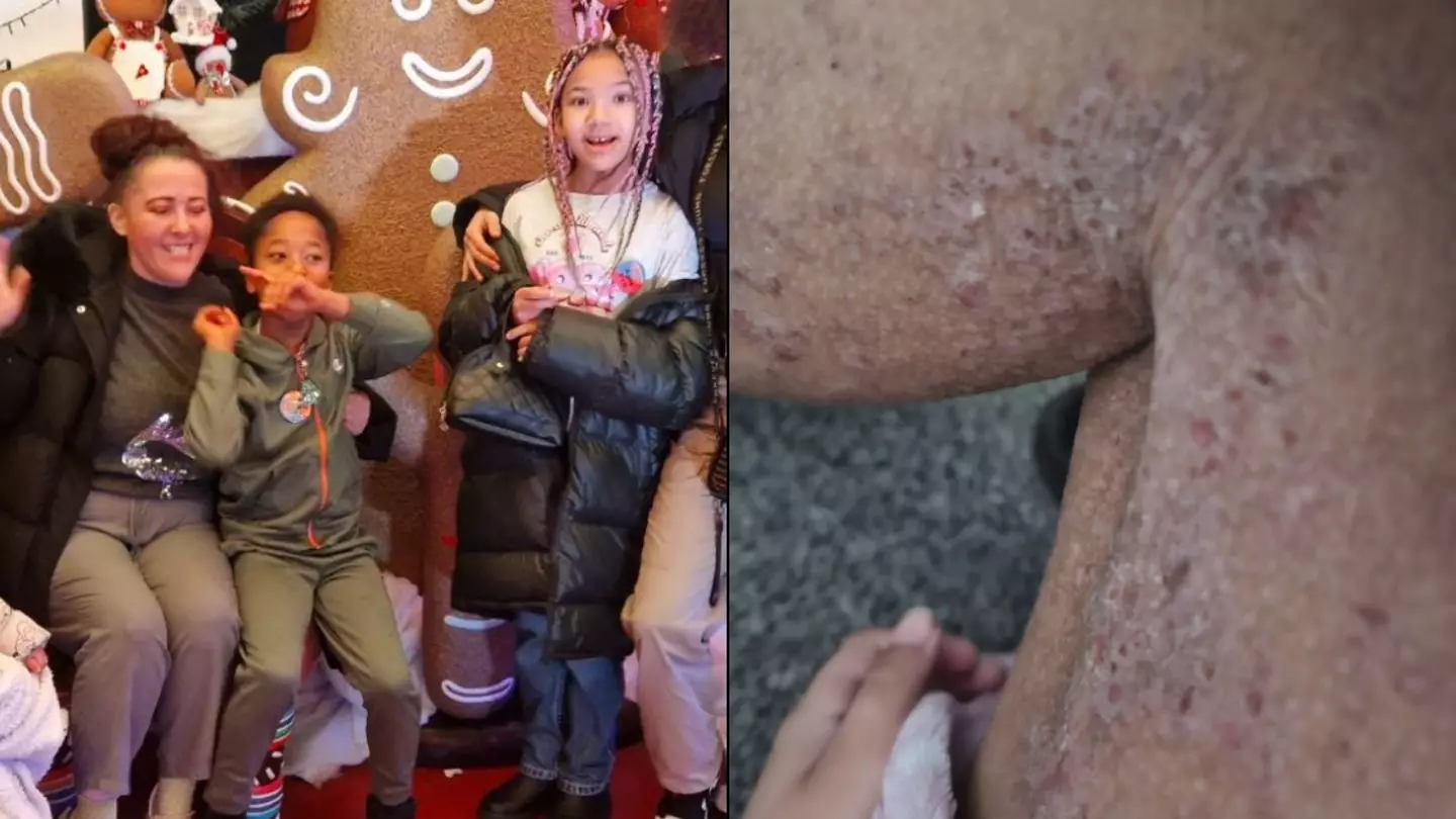 British mum issues warning after daughter is left needing wheelchair after playing with slime