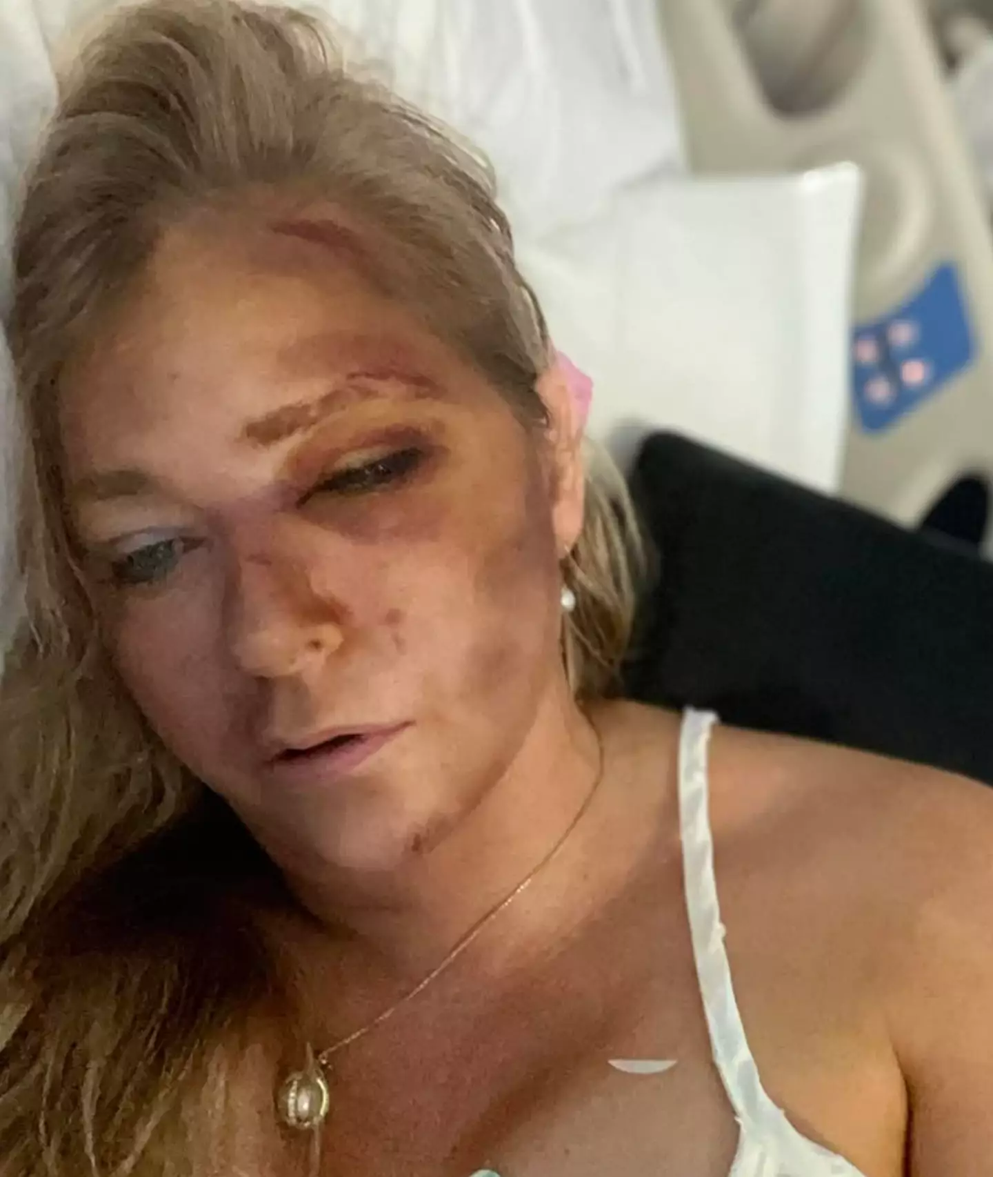 The mum-of-three posted this chilling snap online following her accident (Instagram/@virginiarobertsrising11)