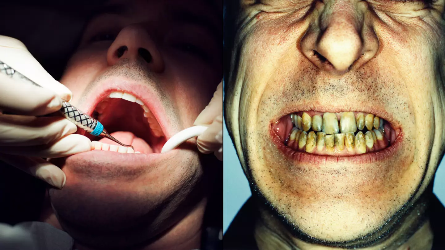 Dentist shares most horrifying cases he’s ever seen on the job