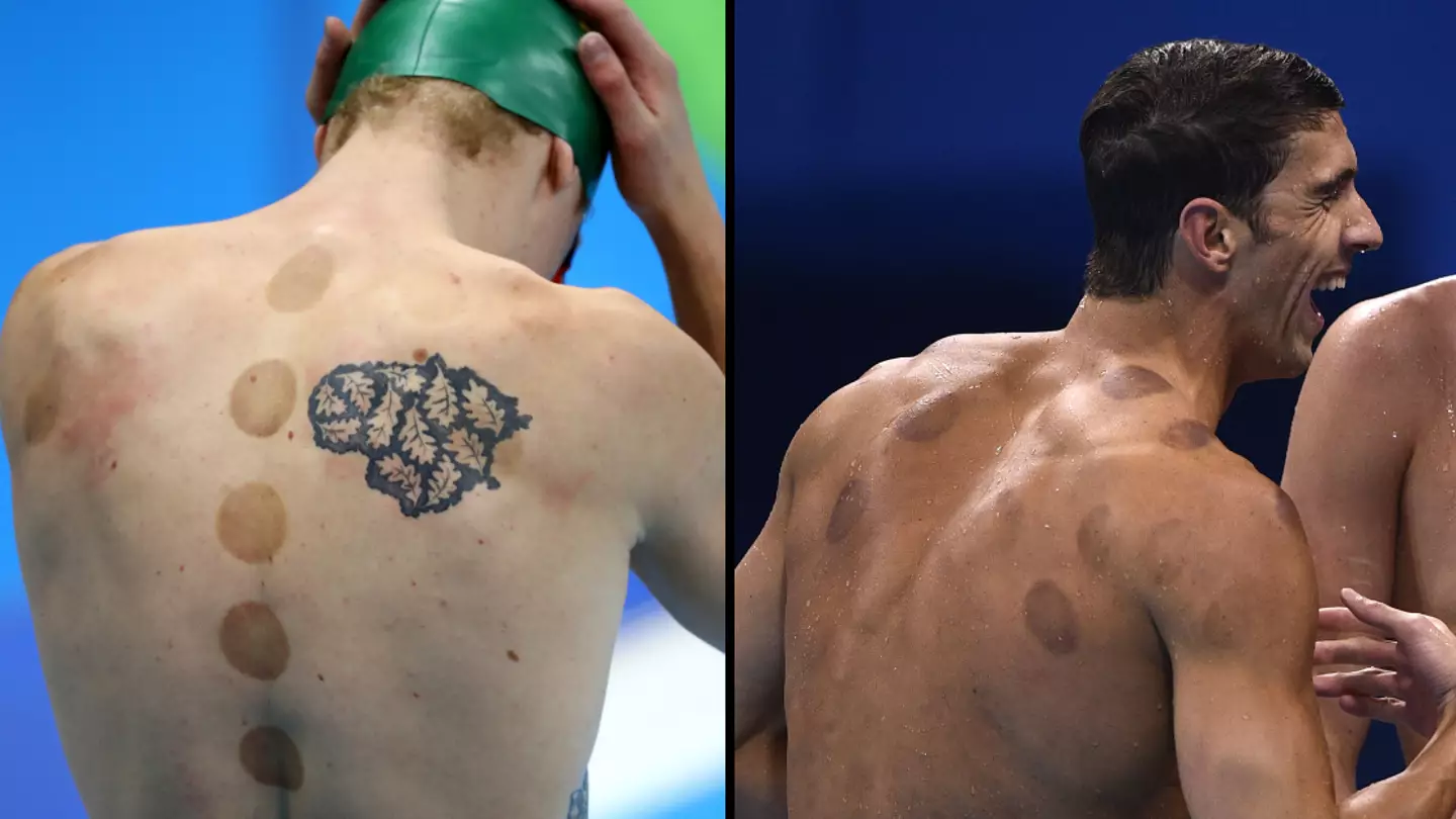 Dean Mouhtaropoulos / Getty Images / MARTIN BUREAU / AFP via Getty Images