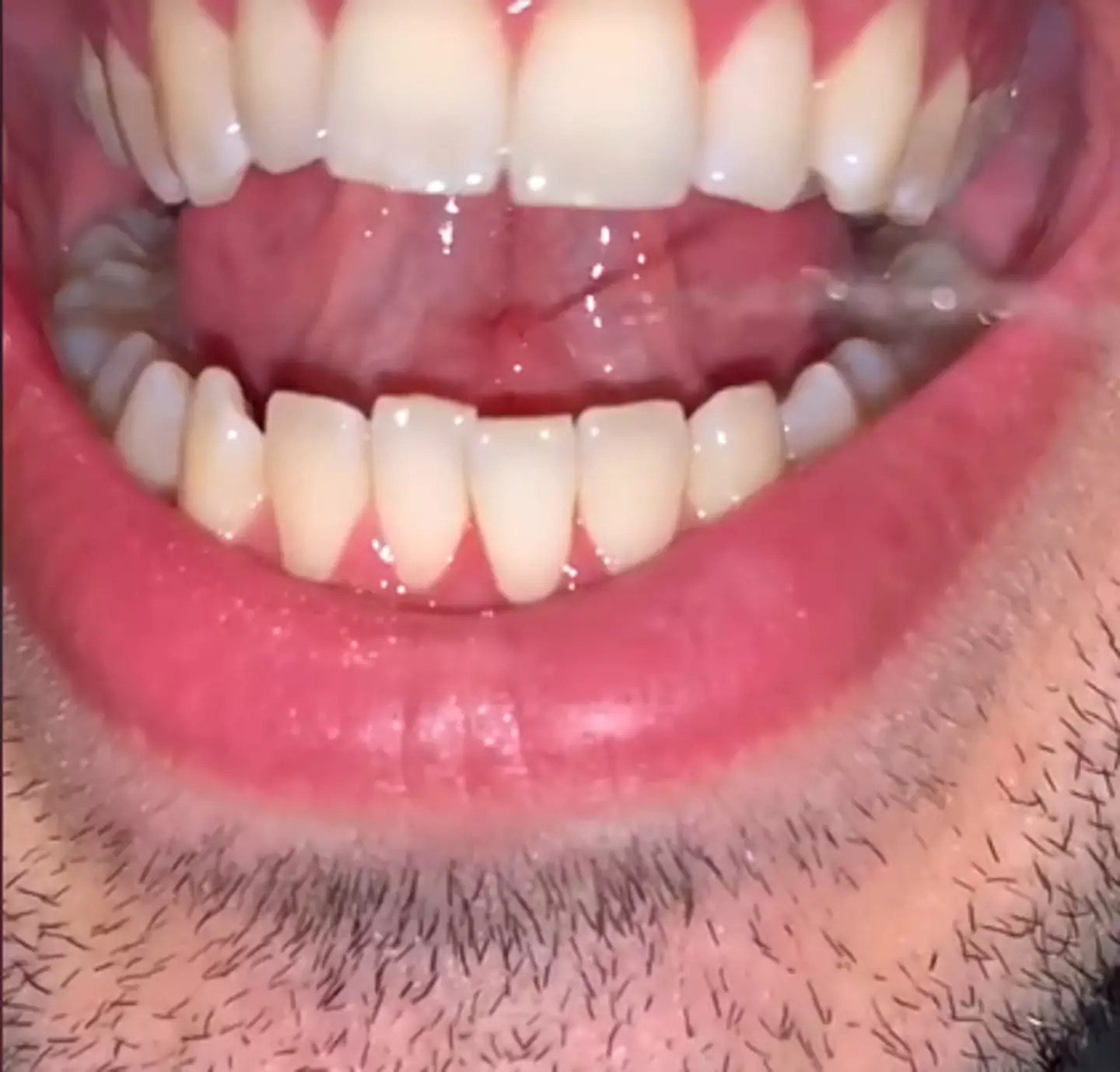 Here one creator shared an up close and personal look at gleeking (TikTok/sebastiankivela)