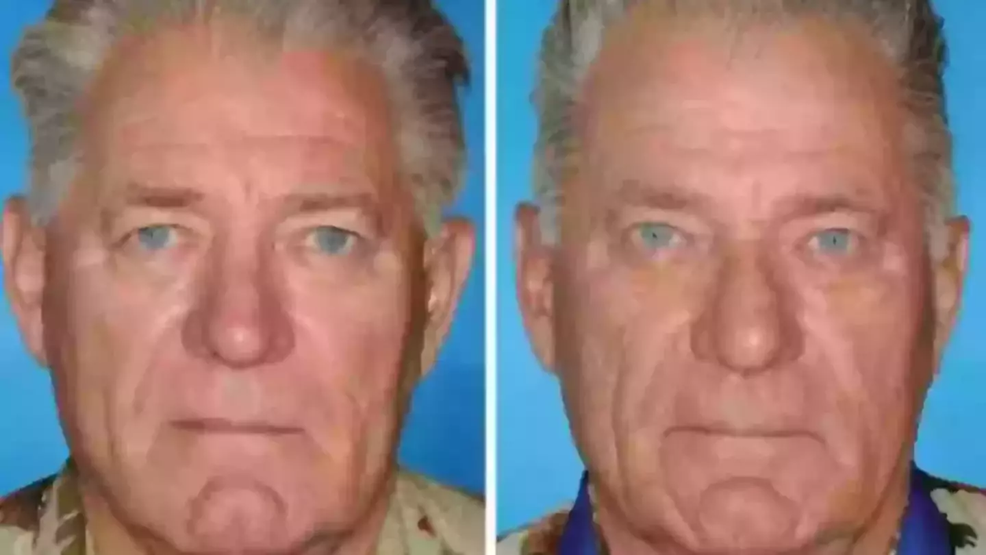 Shocking impact of smoking on twins' face shown in comparison to non-smoker twins