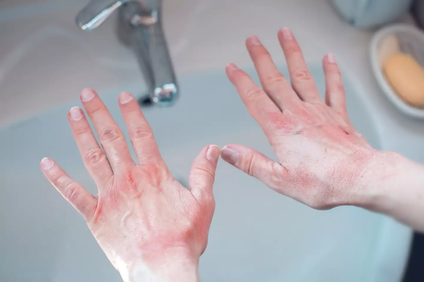 Your skin suddenly changing colour quite significantly is a warning sign. (Getty Stock Photo)