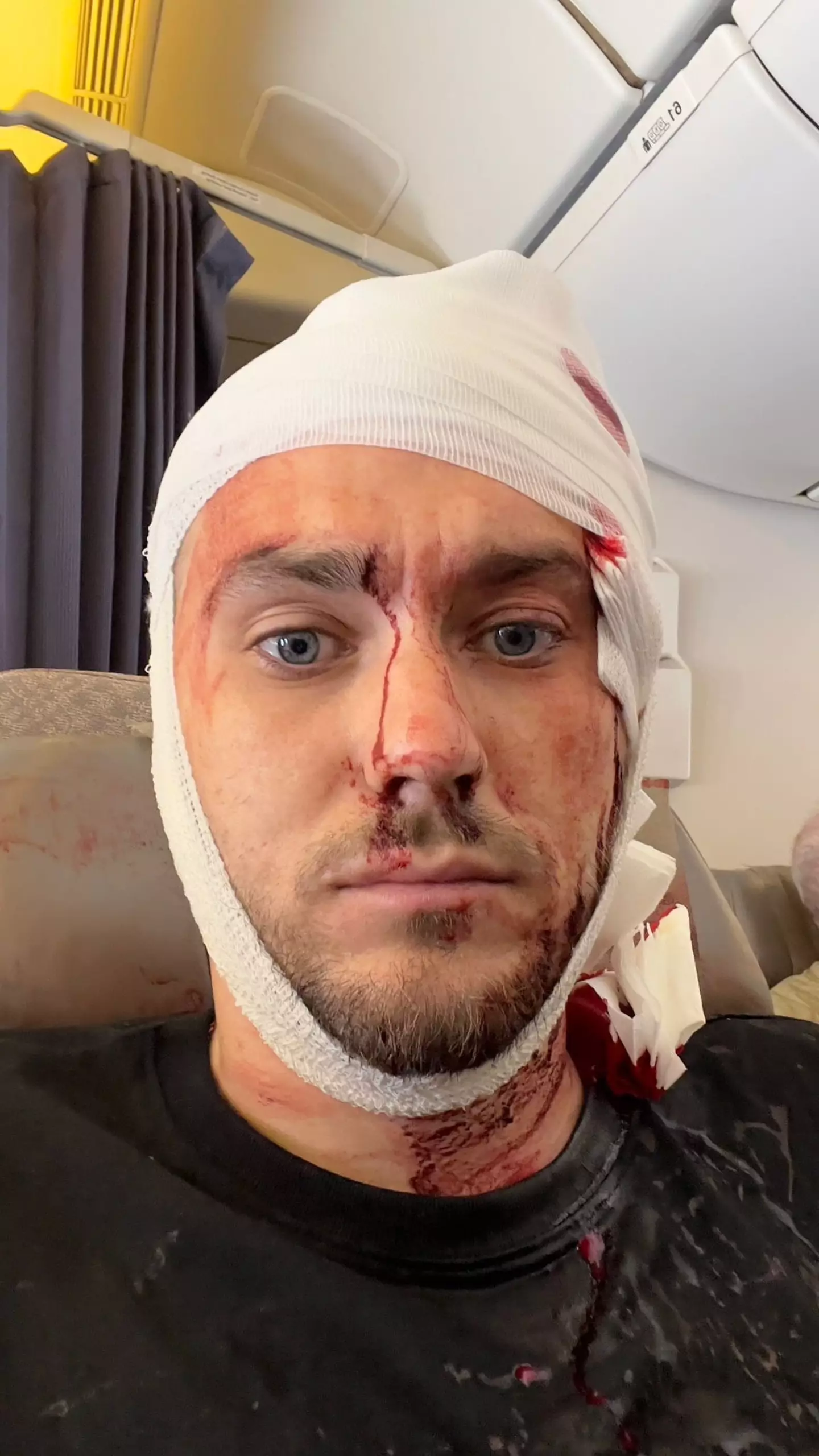 Bradley was seriously injured after his plane was hit by turbulence. (SWNS)