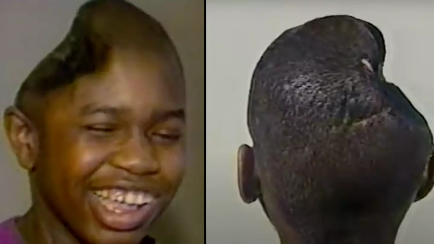 Man who amazed doctors after he cheated death when he lost half his brain after being shot