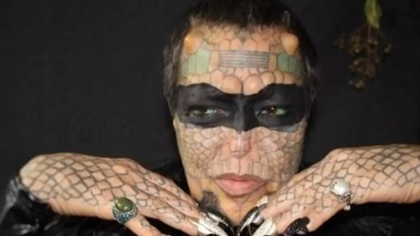 Former Banker Becomes 'Genderless Reptile' After Castration