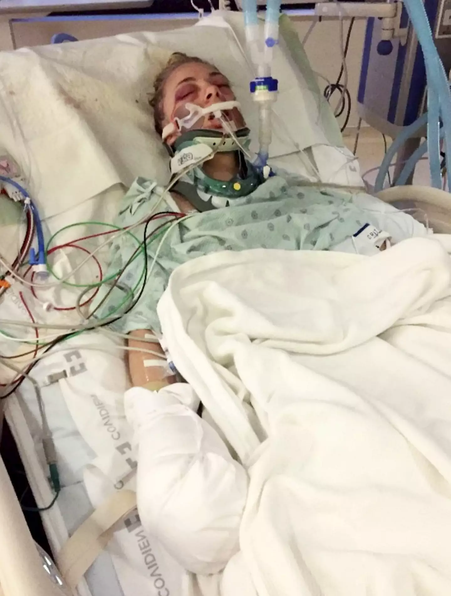 She says she is actually 'happier now' since she's no longer on drugs. (SWNS)