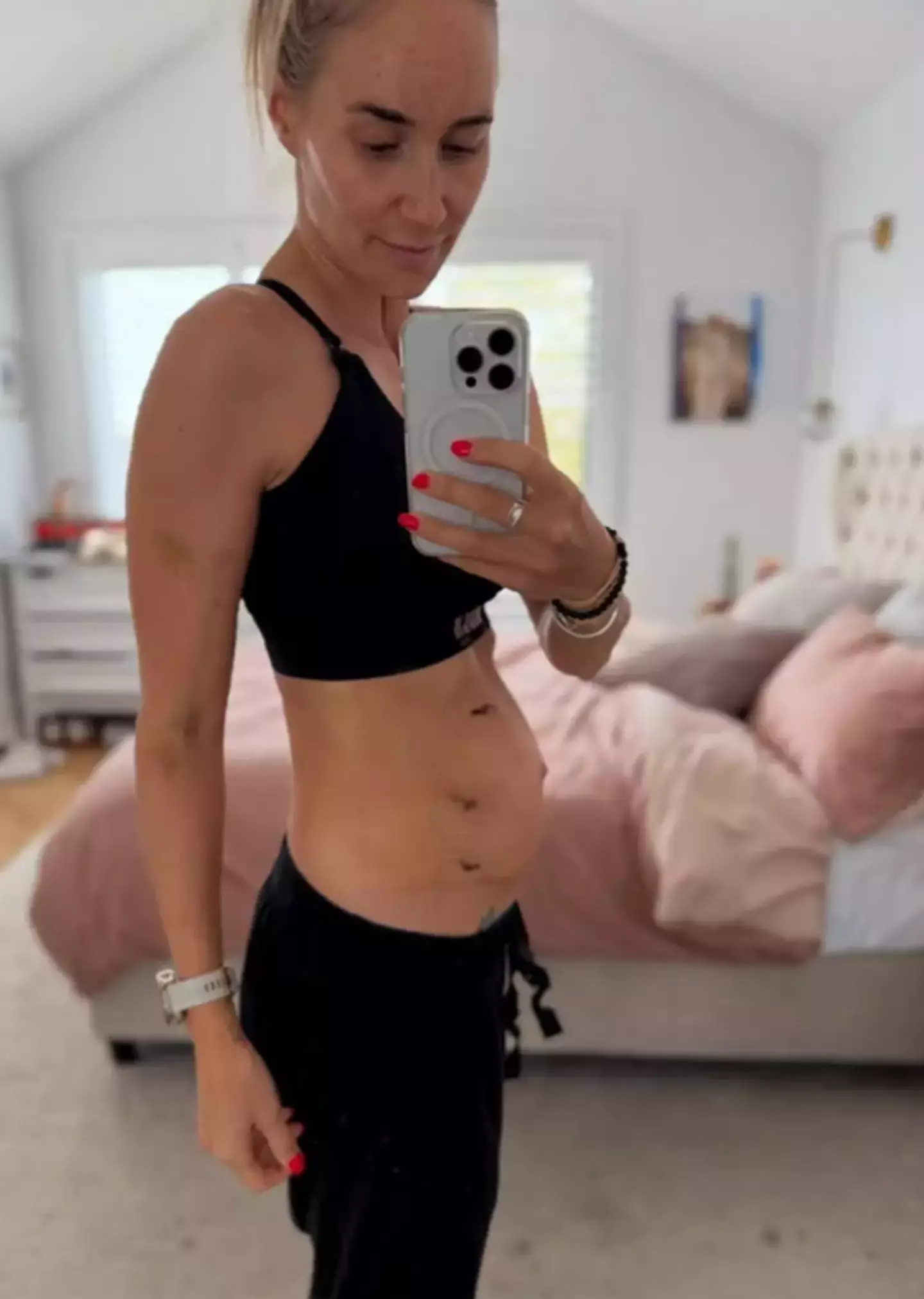 She says she was diagnosed with stage 2 bowel cancer (Instagram/@thefigure_)