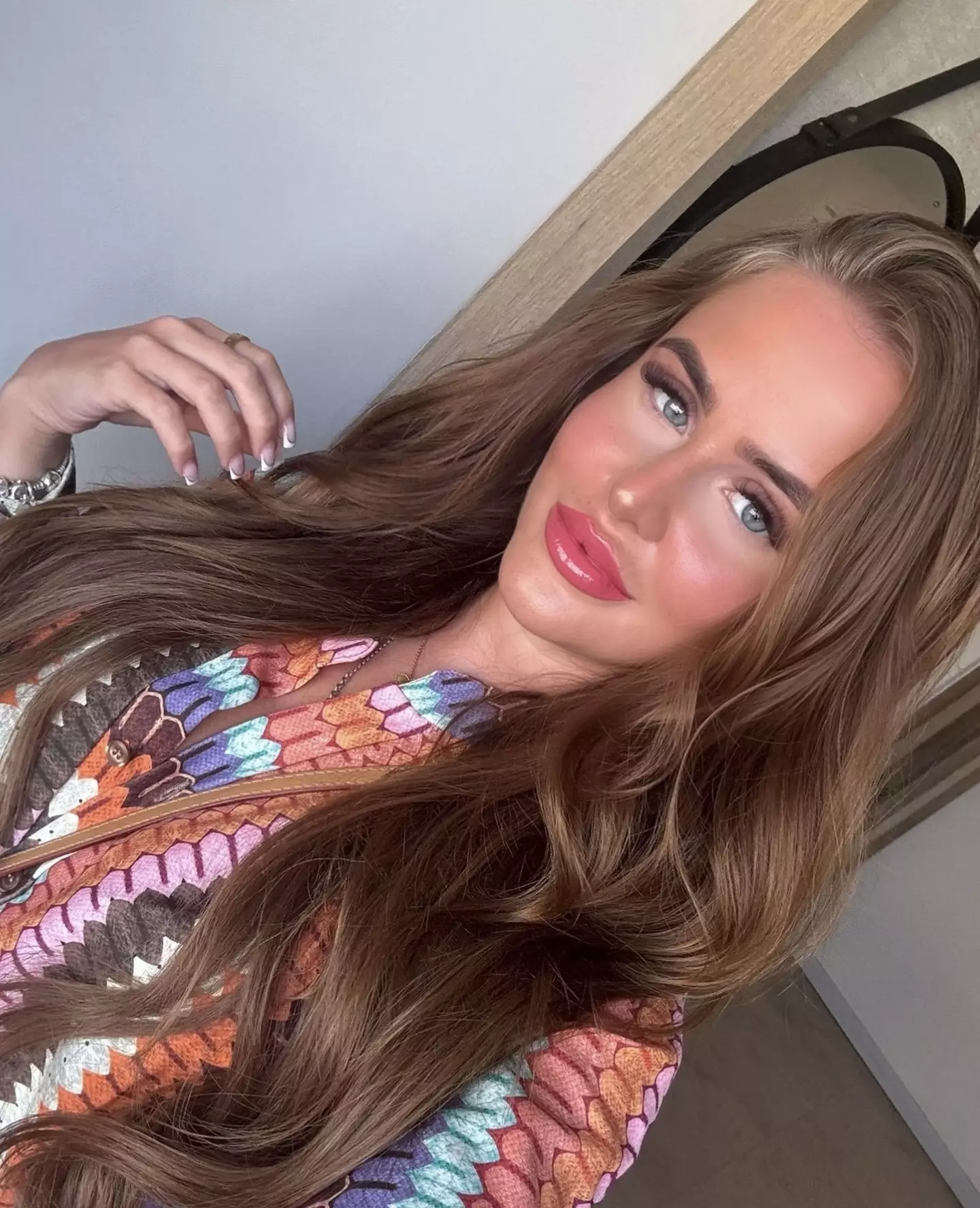 She has warned other contact lens wearers to be careful. (Kennedy News and Media)