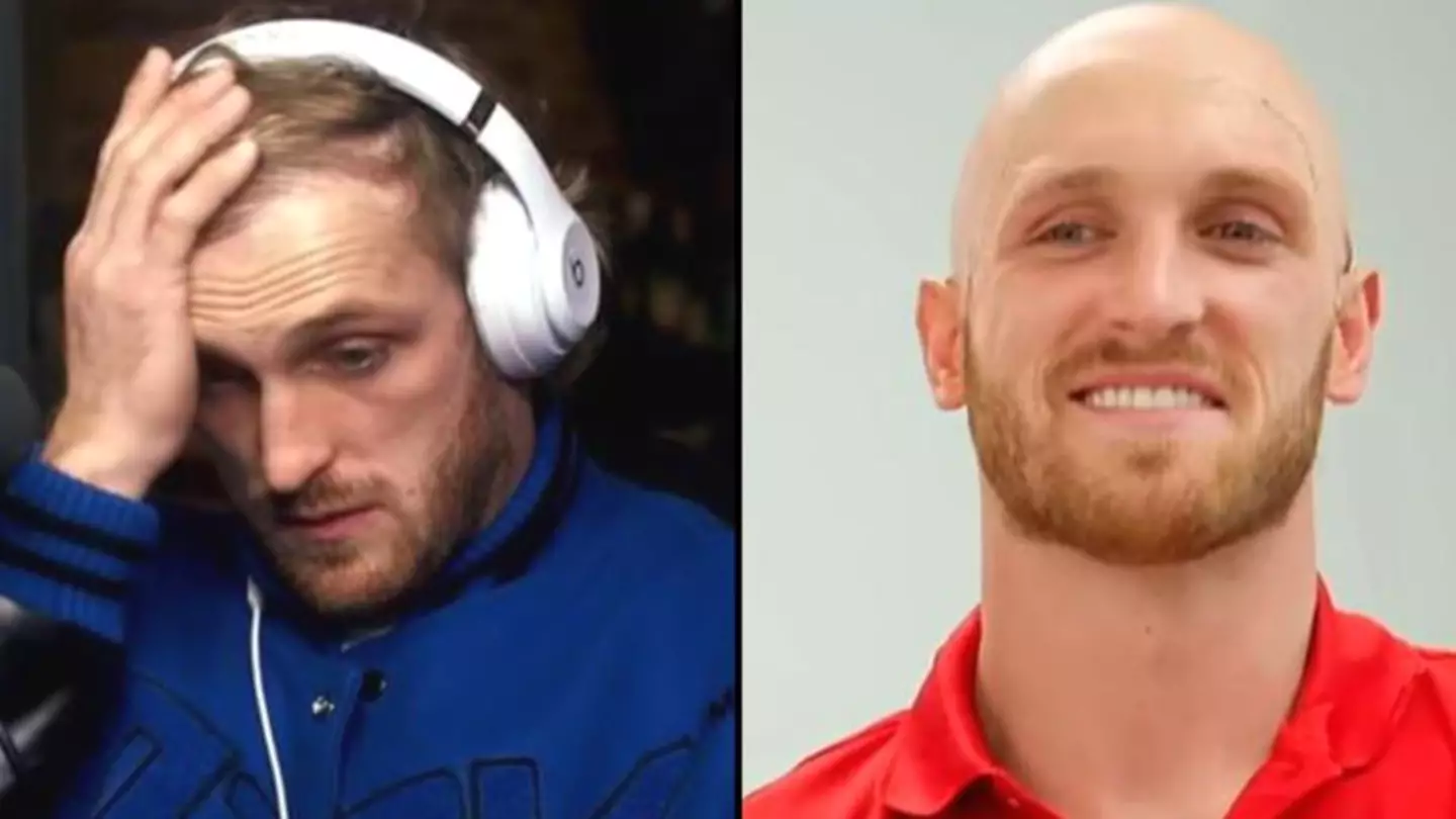 Logan Paul Says He’s Going To Be Bald Within 5 Years