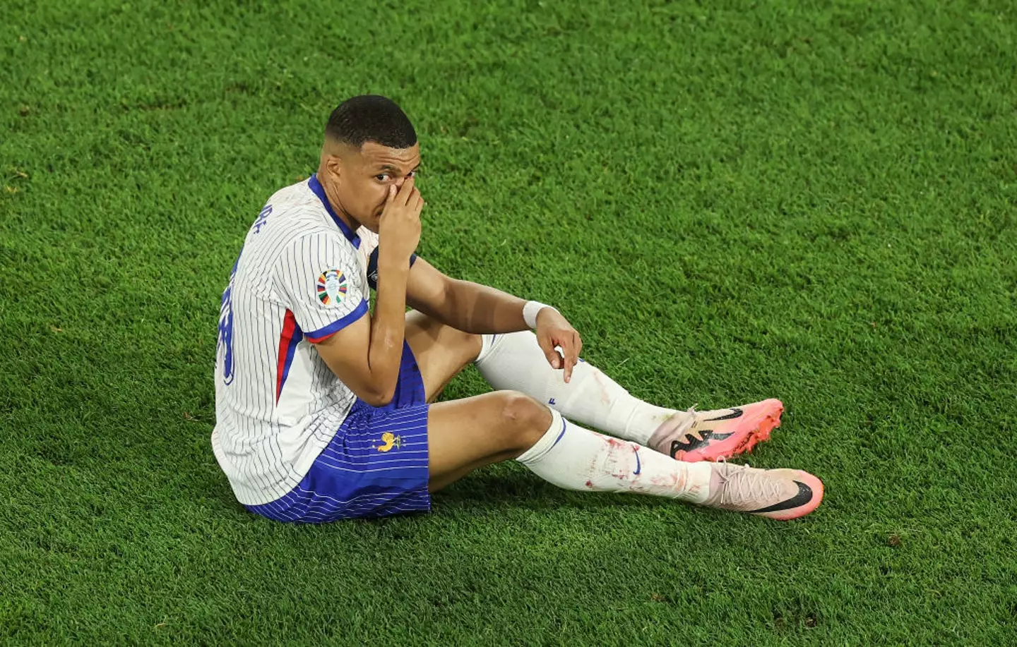 Mbappe broke his nose in a match against Austria (Lars Baron/Getty Images)