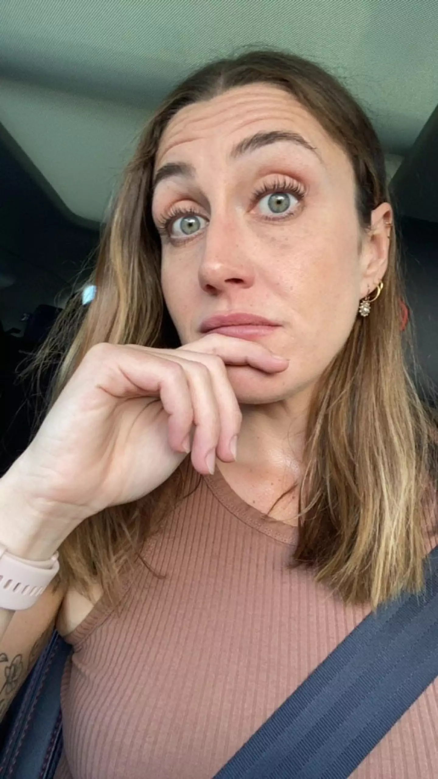 Like many would, Steph simply thought it was just a spot or pimple (SWNS)
