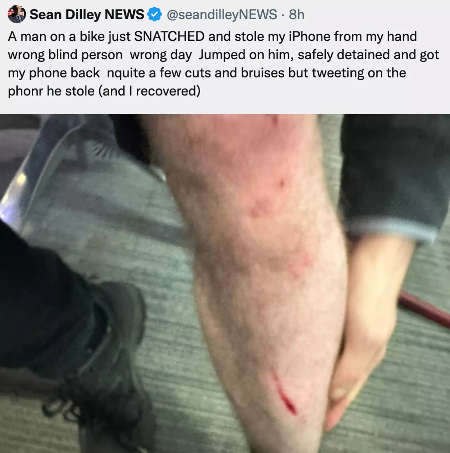 Sean's phone was stolen straight out of his hand.