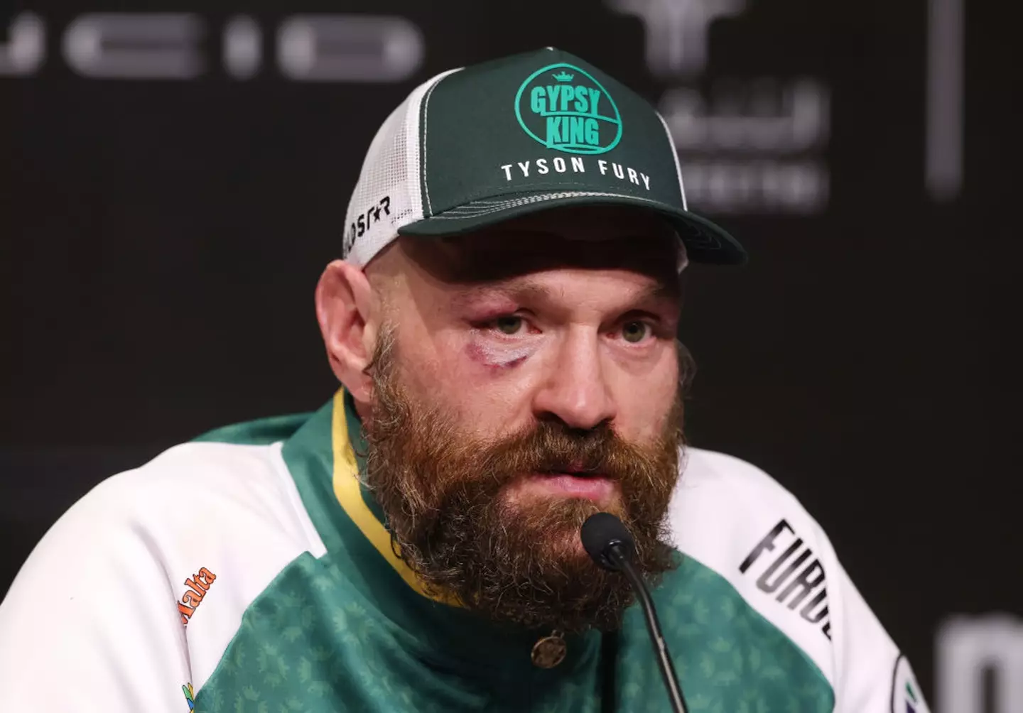 Fury said he was 'robbed' (Richard Pelham/Getty Images)