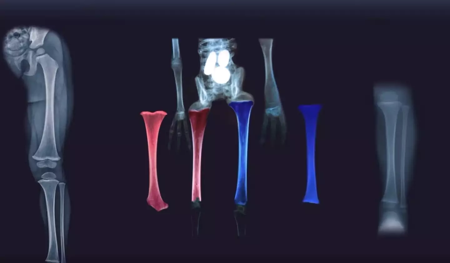 One of the 'aliens' is said to have mismatched human bones.