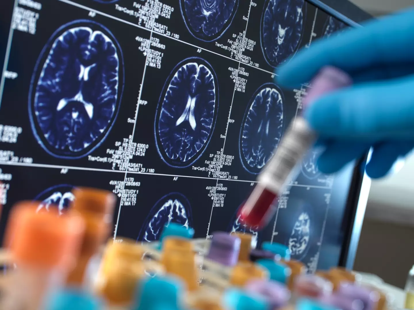 Tests later confirmed that the 41-year-old has early-onset Alzheimer’s (Getty Stock Photo)