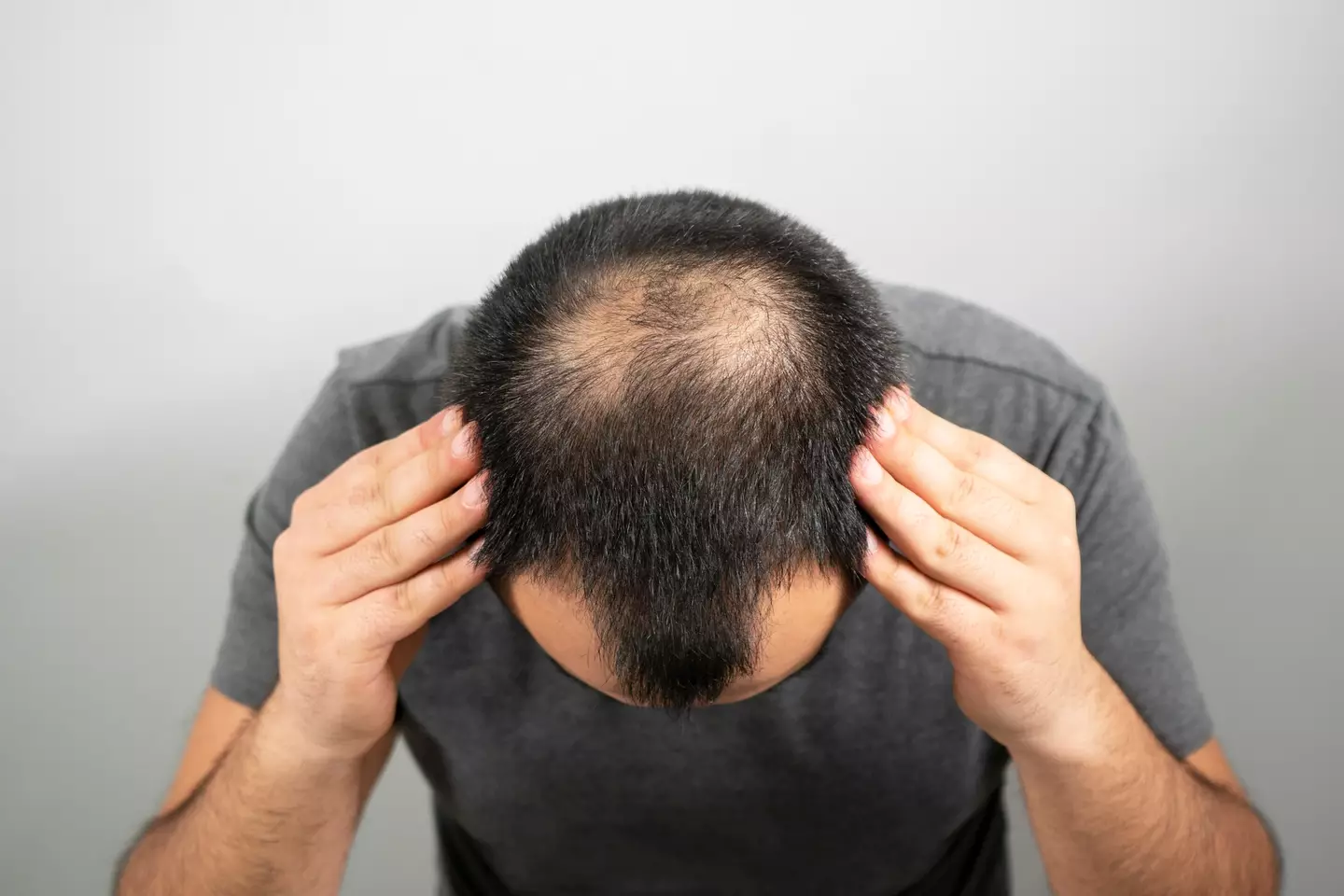 Losing your hair can be a hard thing to process (Getty Stock Images)