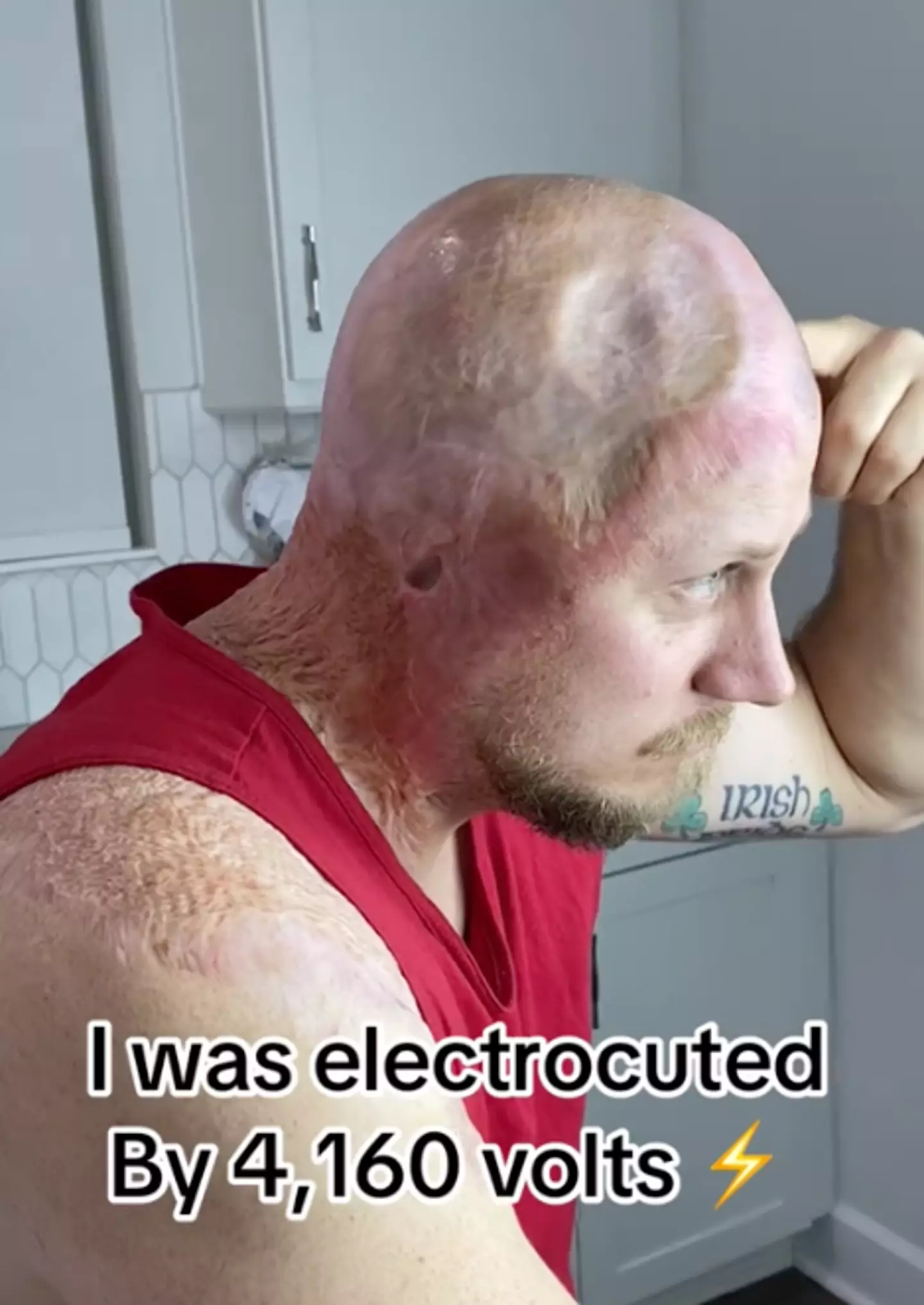 John Pendleton said he 'died twice' when he was electrocuted (TikTok/@johnarcingaheadapparel)