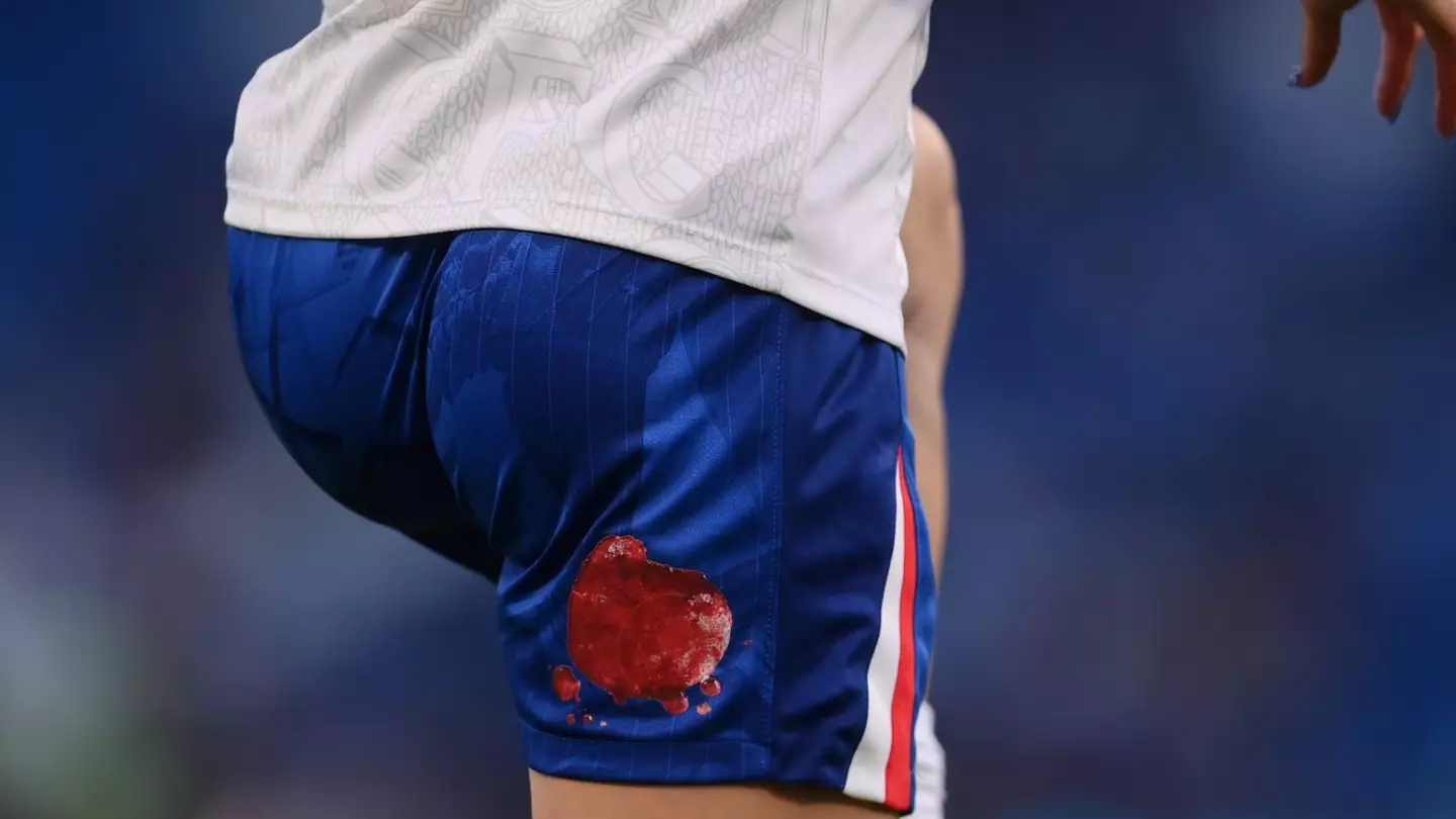 Chelsea FC Women wear shorts marked with simulated blood to address period stigma with ‘We Don’t Bleed Blue. We Bleed. Period.’ campaign