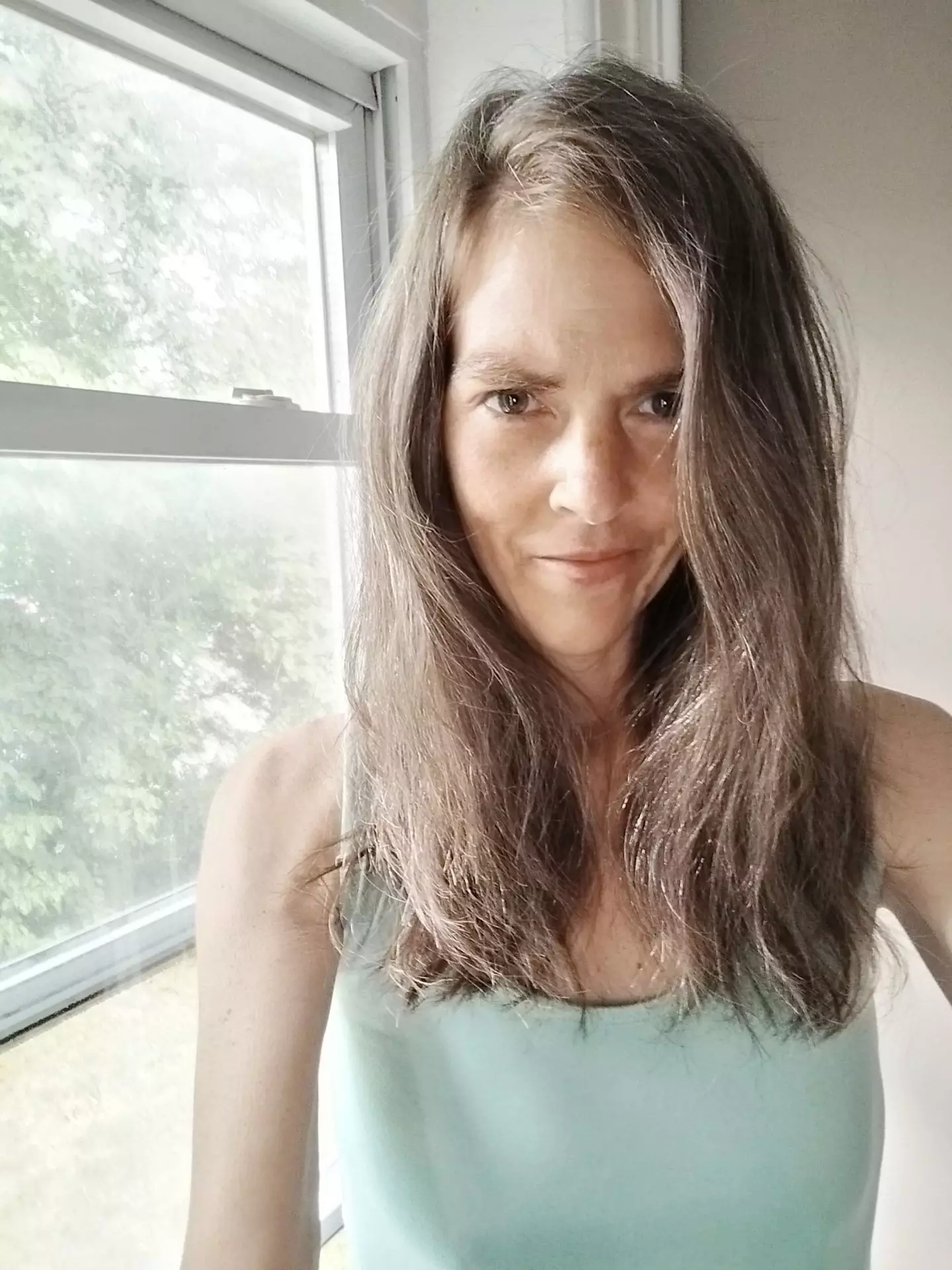 The vape set hair alight and the fire spread across her body (Kennedy News and Media)