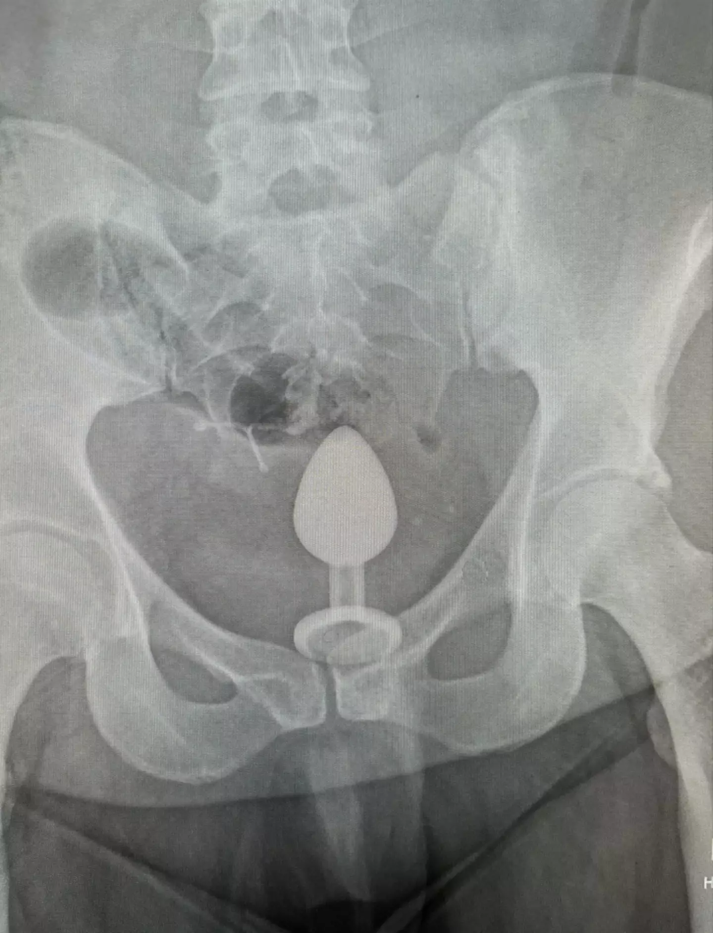 Gigi eventually made it to the hospital where an x-ray revealed the extent of her problems.