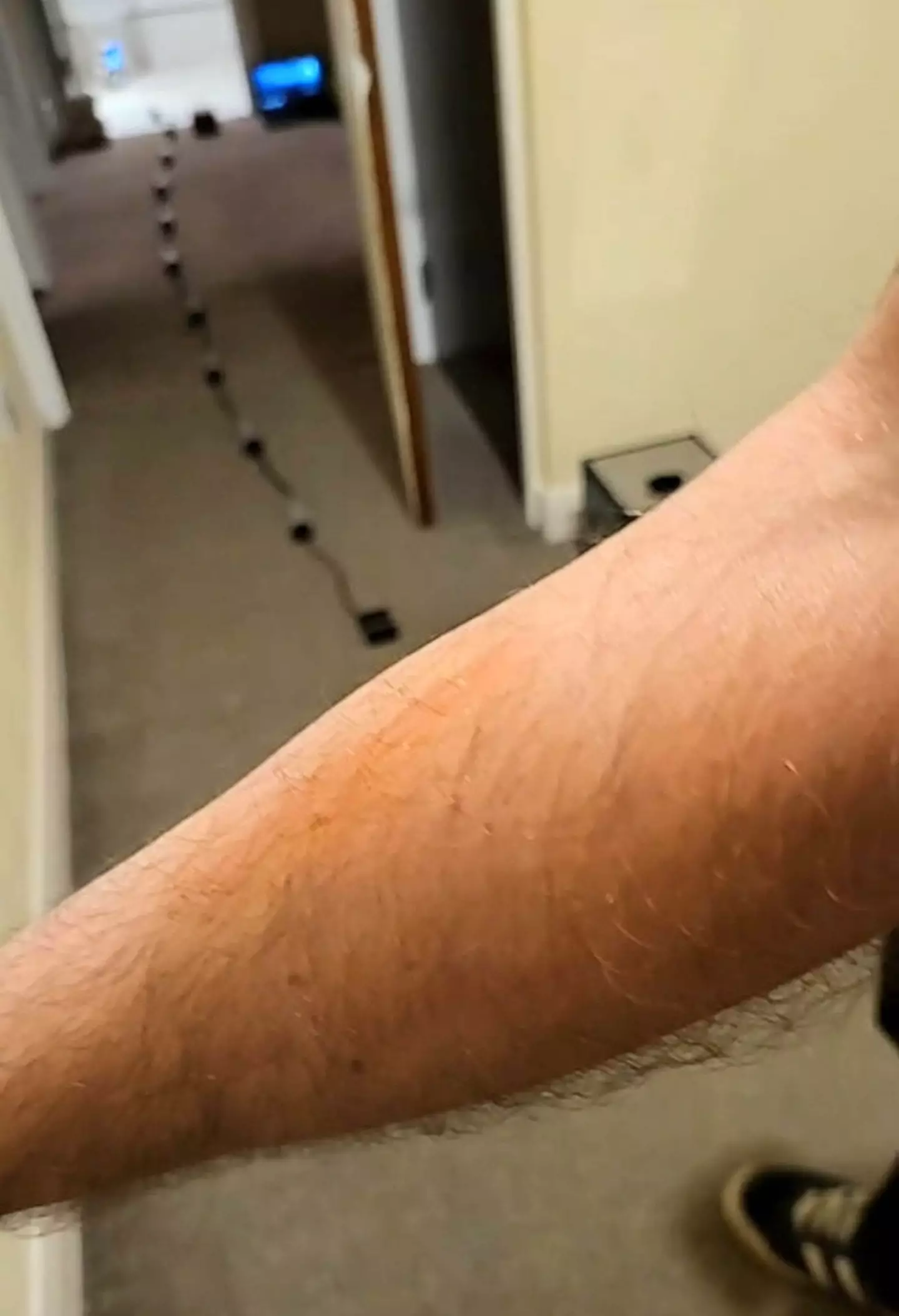 Lee suddenly realised he had scratches on his arm.