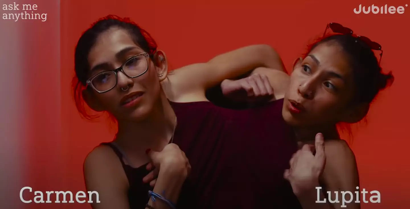 Carmen and Lupita are conjoined twins.