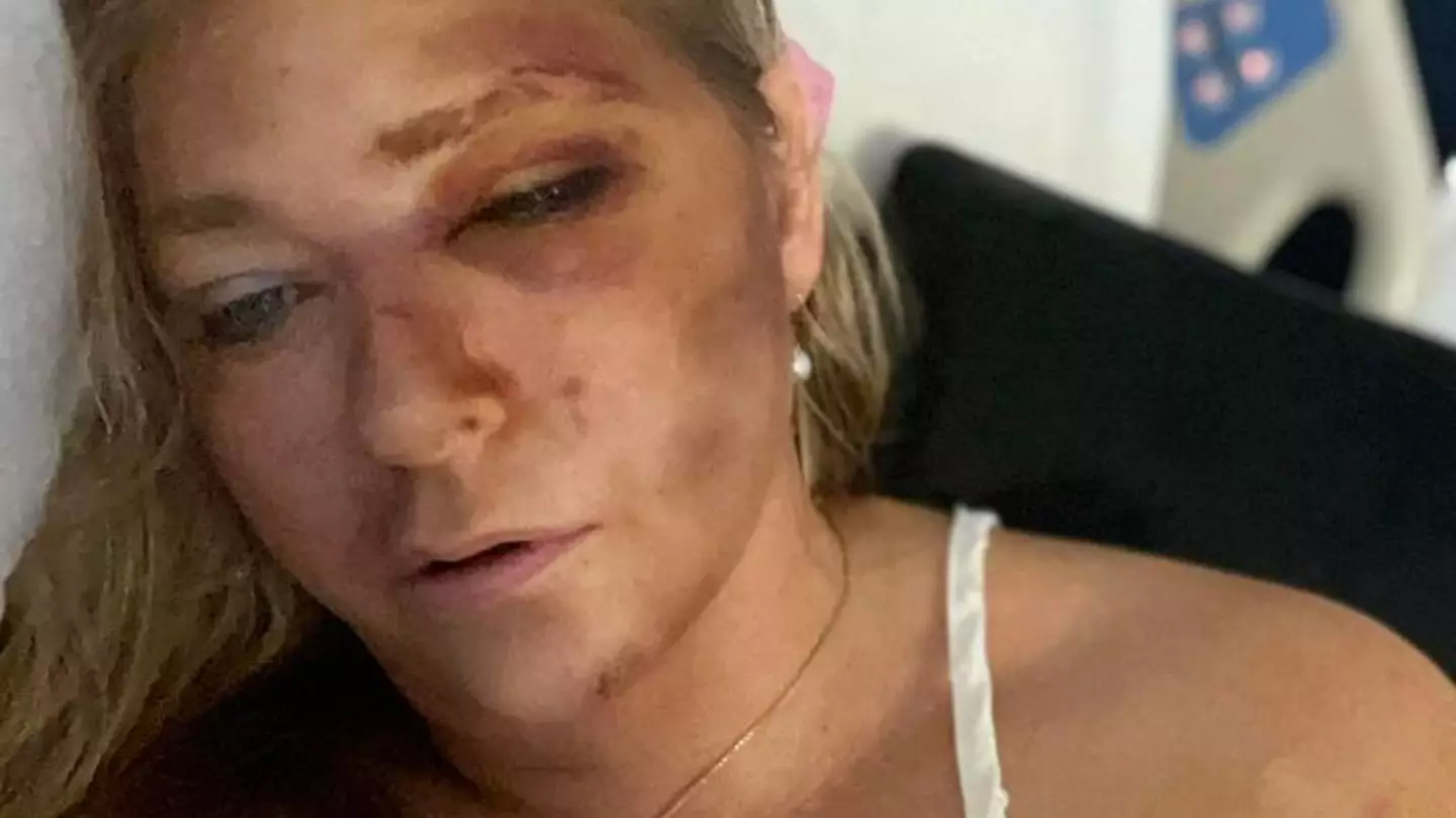 Dad of Prince Andrew accuser Virginia Giuffre shares further details after bus crash leaves her with ‘four days to live’