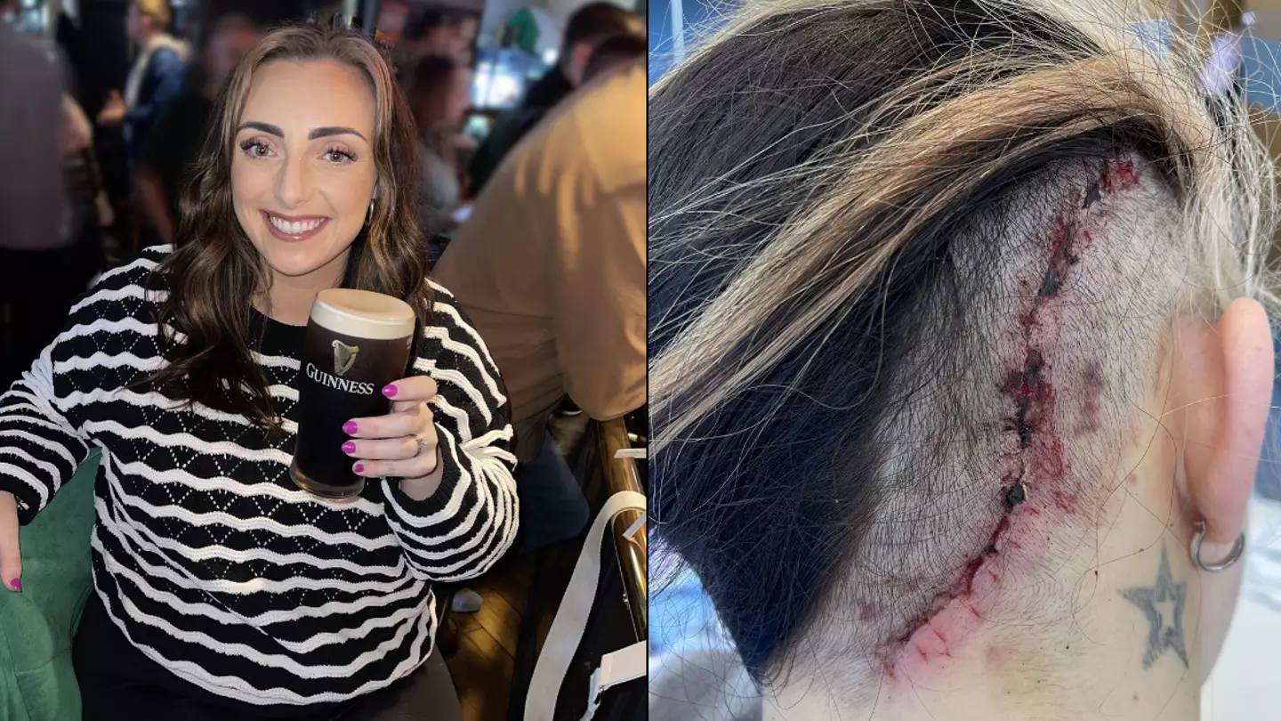 Woman who dismissed twitching eye as ‘college stress’ left unable to smile after finding out devastating diagnosis