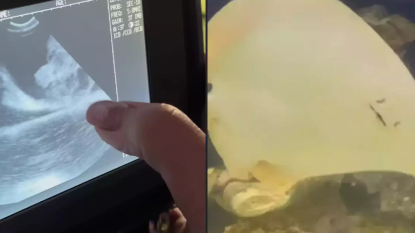 New ultrasound shows inside of a stingray who got pregnant with no other mates in her tank