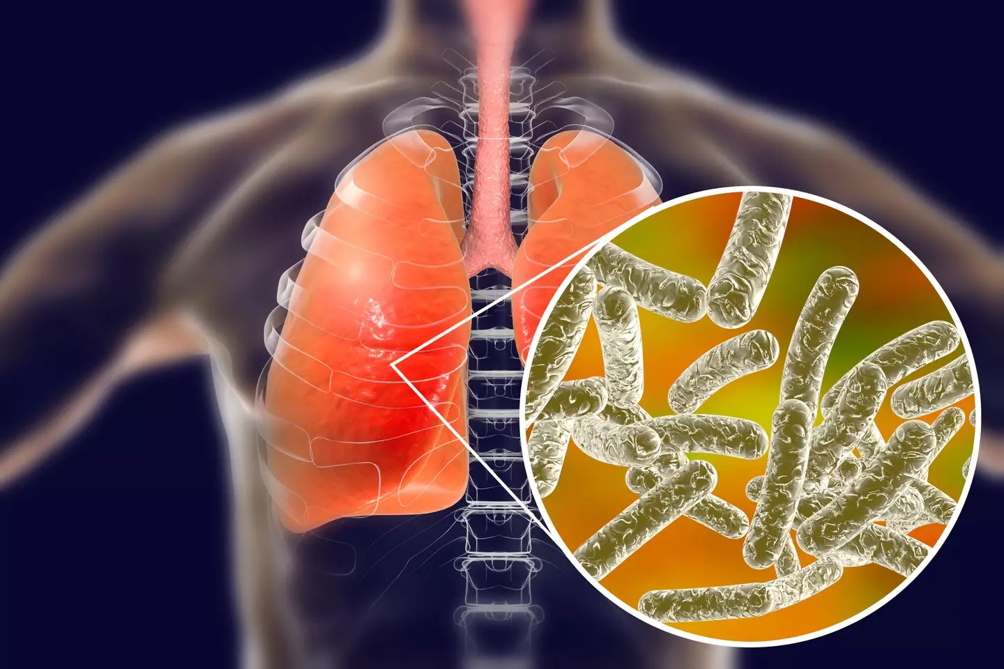 Legionnaire's disease is potentially fatal (KATERYNA KON/SCIENCE PHOTO LIBRARY via Getty Images)