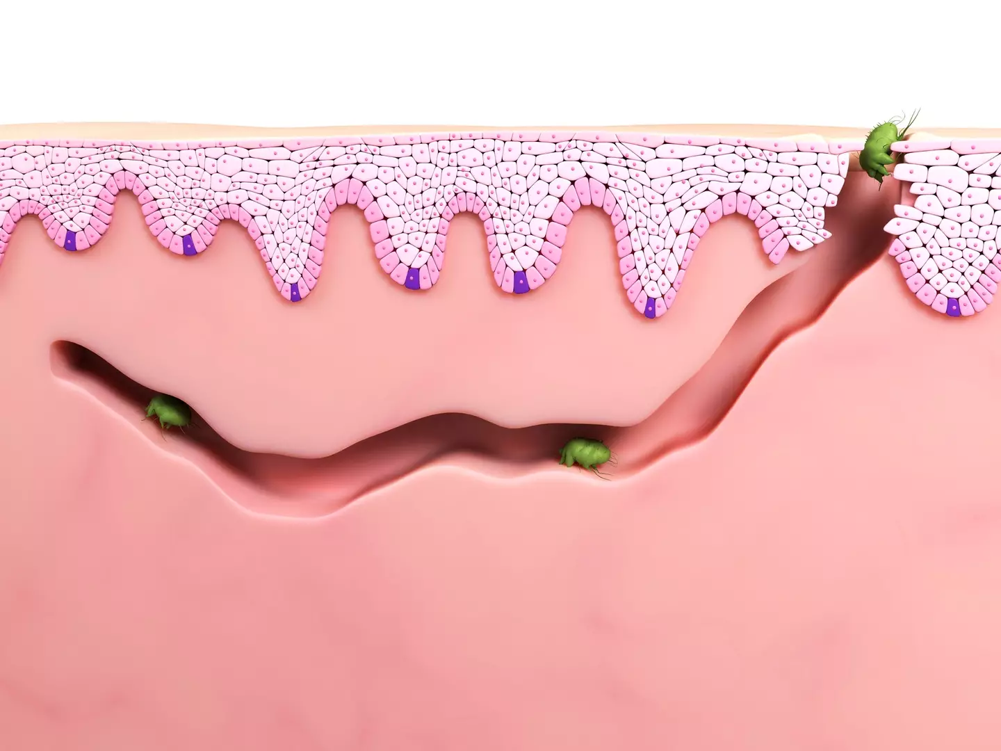 An illustration of what the mites are doing when they burrow under your skin (Getty Stock Images)