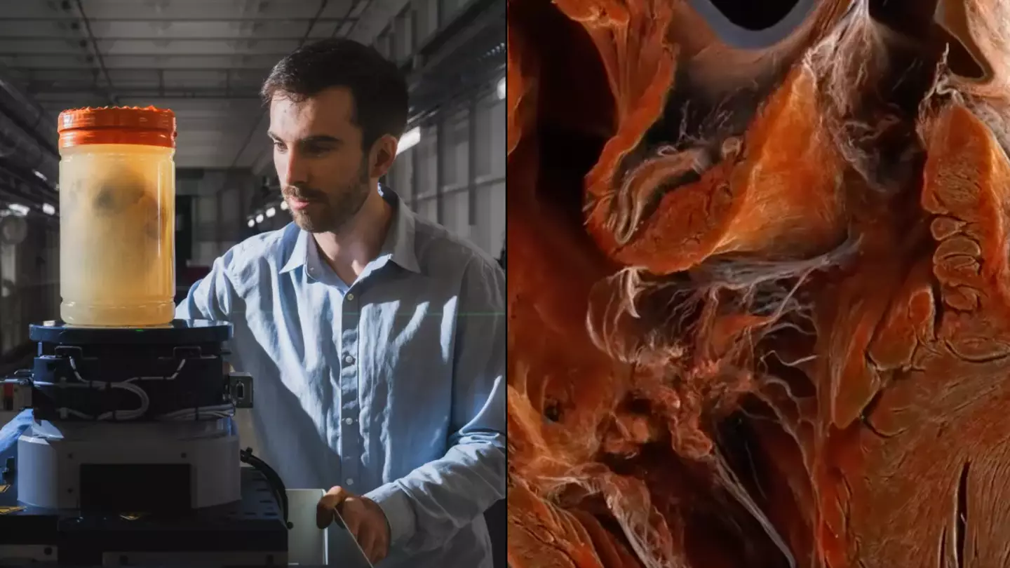 UCL/ESRF/Stef Candé