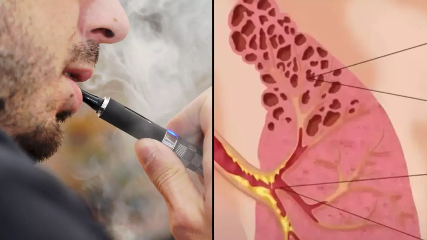 Getty Stock Images/Youtube/The Infographics Show